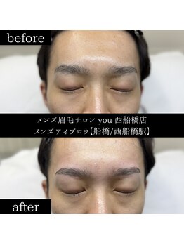 ユー 西船橋店(you)/ビフォーアフター写真