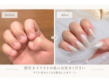 ネイルホーラー(Nail-HAULER)