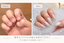ネイルホーラー(Nail-HAULER)