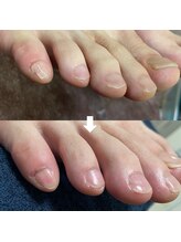 ビビィ(vivie)/本来の美しさ、取り戻します