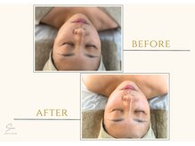 セン(Sen)/ビフォーアフター