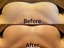 整顔整頭/【下垂予防】