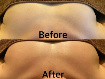 整顔整頭/【下垂予防】