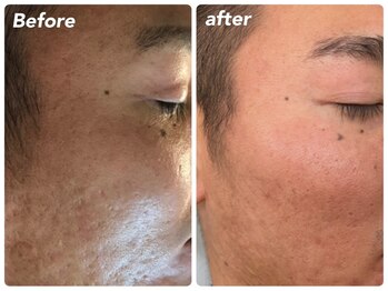 ビューティー アディクト(Beauty addict)/VOSサロンケア