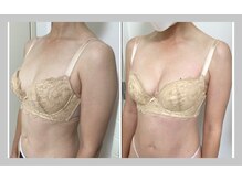 蒼(so)/一回で激変！ふわふわバスト！