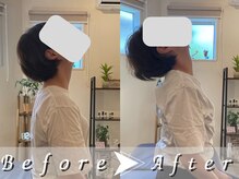 リガクスタイル 明石大久保(RIGAKUSTYLE)/頭痛、肩こりは首から！