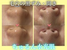 ハニエル(Haniel)の雰囲気（毛穴の詰まり・開きも当店にお任せ☆化粧崩れ気にならない肌へ♪）