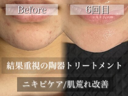 リイル バイ クレビア(REILE by Crebia)の写真