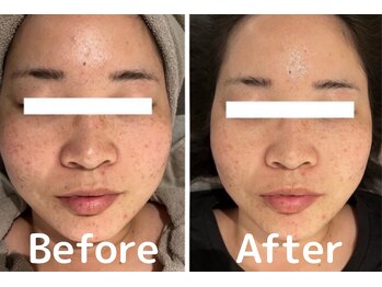 ラポール 野並店(Rapport)/