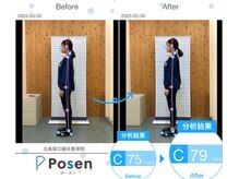 北島坂口鍼灸整骨院/ビフォー、アフター！