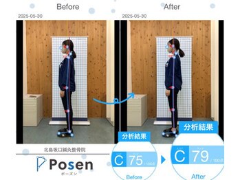 北島坂口鍼灸整骨院/ビフォー、アフター！