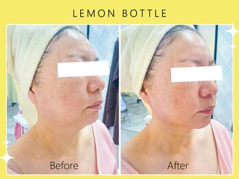 ハノハノ 八代店(HANO HANO)/【八代初導入！】レモンボトル☆