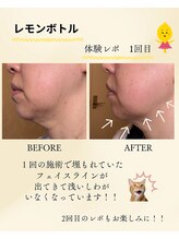 頭のオアシすぱ/レモンボトルで二重アゴ改善！3