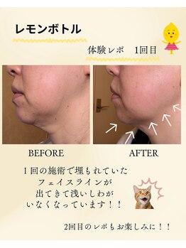 頭のオアシすぱ/レモンボトルで二重アゴ改善!3