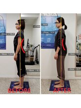 きっと整体院/反り腰が気になる方へ