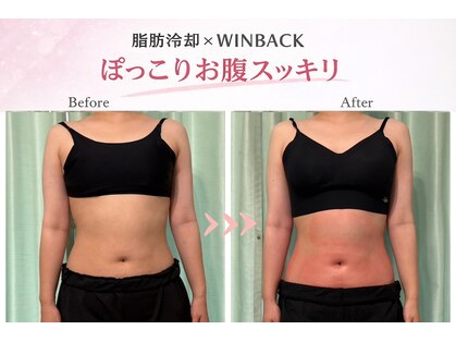 サロンドモモ(SALON de MOMO)の写真