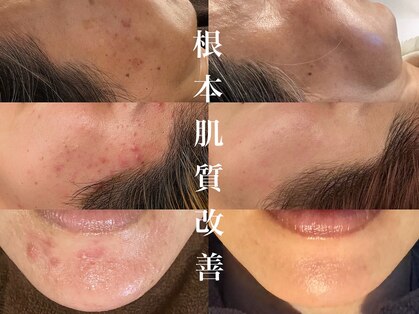 美顔研究所 バイ ヴィヴセカンド(美顔研究所 by viv 2nd)の写真