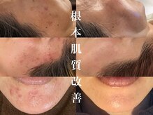 美顔研究所 バイ ヴィヴセカンド(美顔研究所 by viv 2nd)