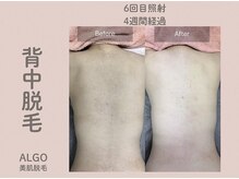 アルゴ 高槻店(ALGO)の雰囲気（【実力派サロン☆】結果重視で効果が早い！のお声多数◎）