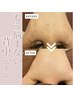 ピーリングで背中ケア