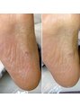 エレナ(ERENA) 男性も施術可能です。