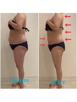 スペチアーレ 夙川/お得に痩せれる最強痩身