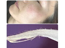 リバイブ(REVIVE)/顔にはこんなに産毛がこんなに！