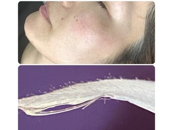 リバイブ(REVIVE)/顔にはこんなに産毛がこんなに！