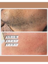 リアンジェ(Lianje)/お顔ワックス脱毛