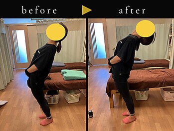杉本接骨鍼灸院/背骨から全身がユルユル整体
