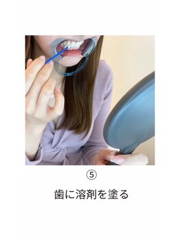 エクシアホワイト 山形西バイパス店/ホワイトニング施術の流れ