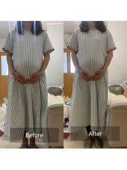 キアラ(Chiara)/マタニティ・ビフォーアフター