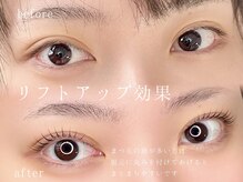 リルフィーユ(Rire Feuille)/リフトアップ効果