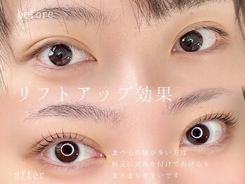 リルフィーユ(Rire Feuille)/リフトアップ効果