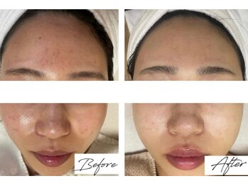 ラポール 野並店(Rapport)/