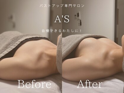 エース(As)の写真