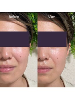 ハートランド(HEARTLAND)/