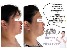 ルピナージュ(Lupinage)の雰囲気（【フェイスラインすっきり/ハリ弾力UP】ACフェイシャル）