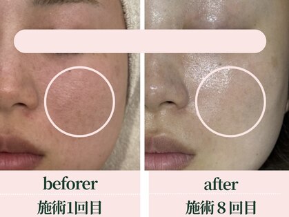 サロン アンジュ(salon.anju)の写真