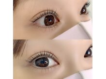 リット(LIT)/上下ラッシュリフト