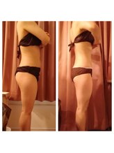 マルロ美容整体院 バイ サロンリーナ(MARLO美容整体院 by Salon Lena)/C様お腹,太もも,ヒップ周り中心