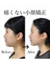【Linoa式小顔矯正リフトアップ50分】お顔の歪み改善、小顔効果◎¥7,700