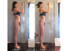 痩身 セル脂肪専門 スタイルデザイン/ヒップアップ→腰位置高く→脚長