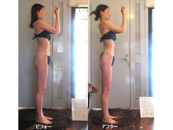 痩身 セル脂肪専門 スタイルデザイン/ヒップアップ→腰位置高く→脚長