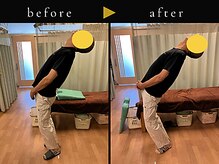 杉本接骨鍼灸院/背骨から全身がユルユル整体