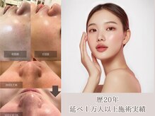 パルタージュ(Partage)の雰囲気（ニキビ/毛穴ケア/シミケア小顔/お悩みの深い肌トラブル緩和に◎）