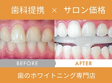 ホワイトニングセンター 札幌白石