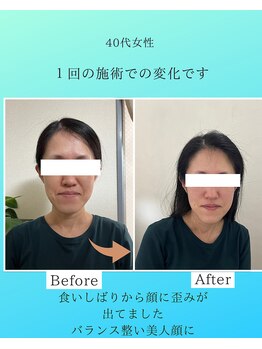 マハロ 海老名店(Mahalo)/小顔矯正　40代女性