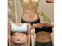 ヨサパーク ハーブメロディー 鈴鹿店(YOSA PARK)の雰囲気（全身の筋肉・リンパの流れに沿って老廃物の排出を促進）