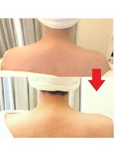 サロンドエステケイワイ(de KY)/小顔・タルミ改善